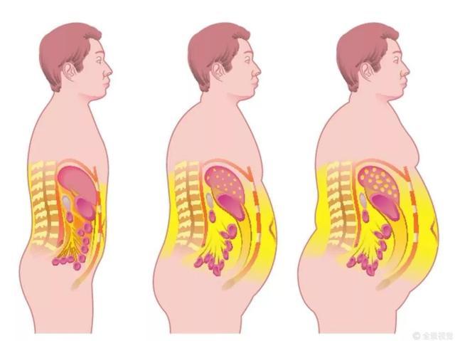 大多数人可能不知道脂肪并非全部都是肥胖的"罪魁祸首",有些脂肪是