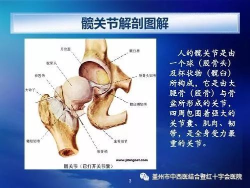 股骨头坏死有哪些症状?