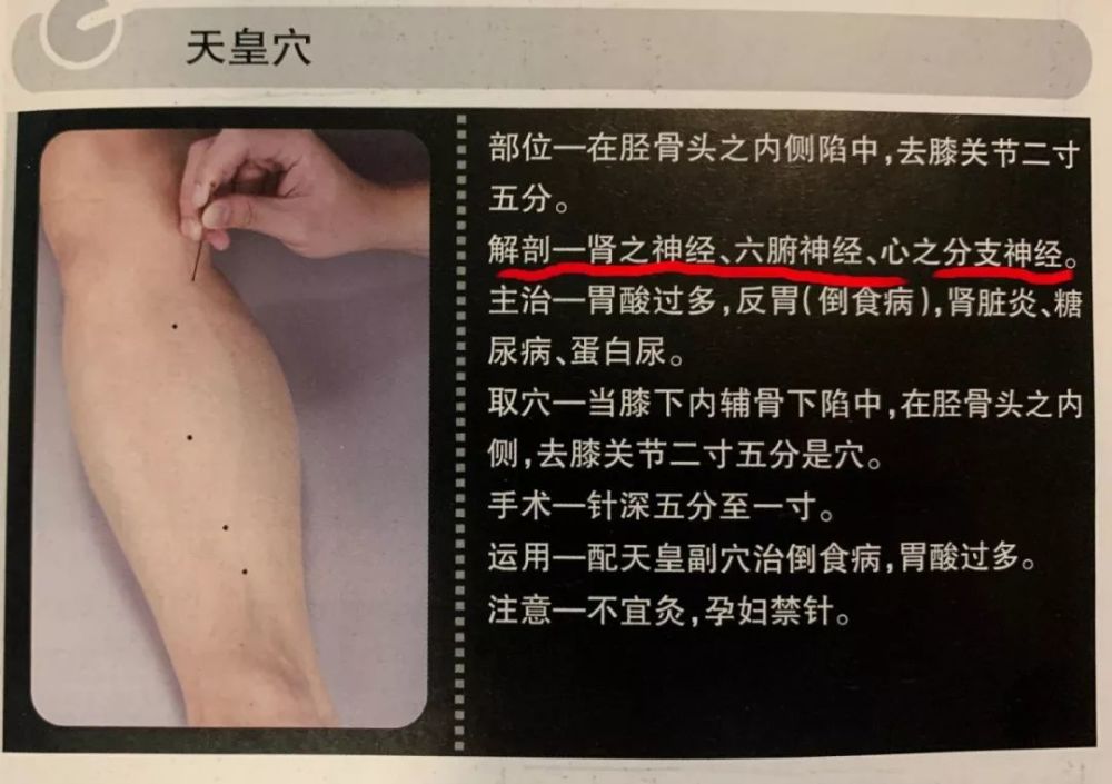 论董氏奇穴的"解剖"
