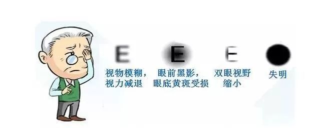 糖尿病人甚至几十年的糖尿病人来说,很有可能会出现糖尿病眼病并发症