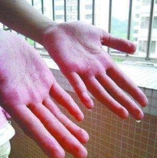 手严重爱出汗什么命
