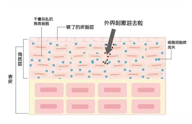 敏感肌肤到底能不能做微针?