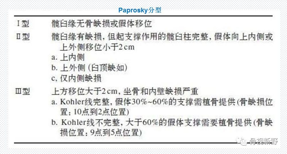 髋臼骨缺损的paprosky分型及其翻修处理原则