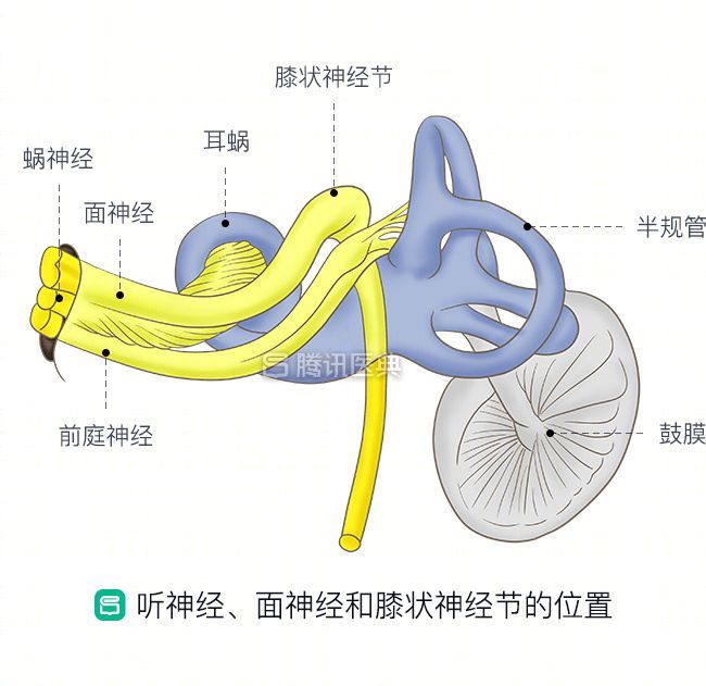 它是不明原因导致的一种以特发性膜迷路积水为病理特征的内耳疾病,是