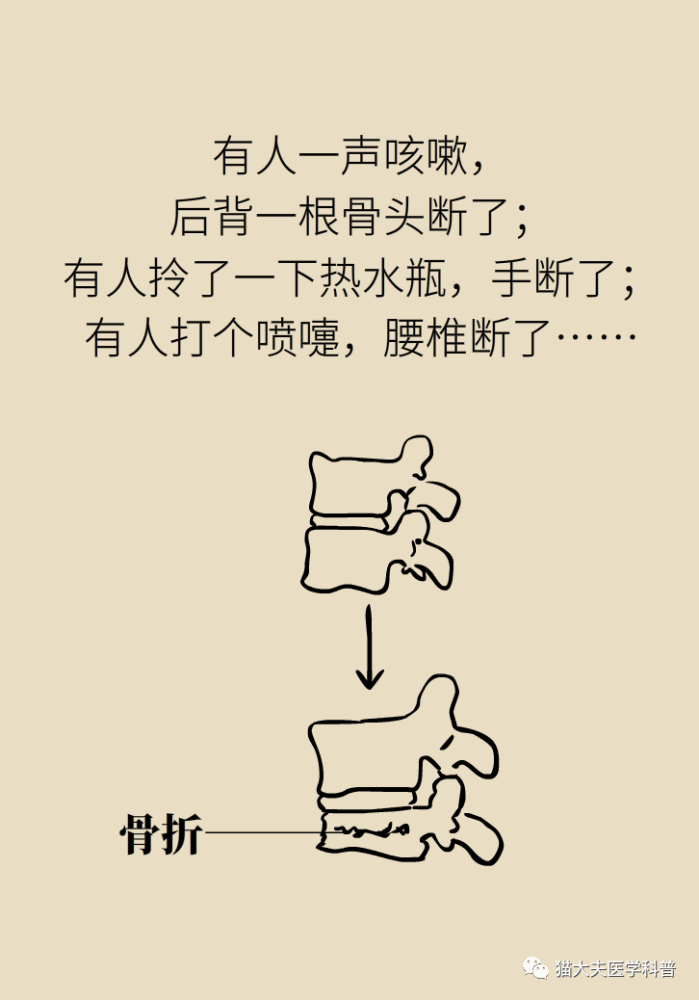 打个喷嚏,老腰断了!什么病这么要命!