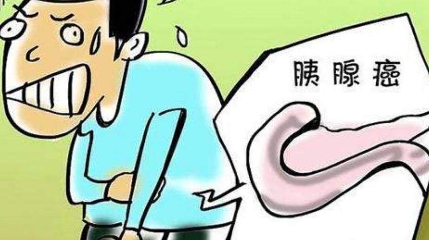 胰腺癌早期有征兆,身体或会发出这3个"提醒",不要忽视
