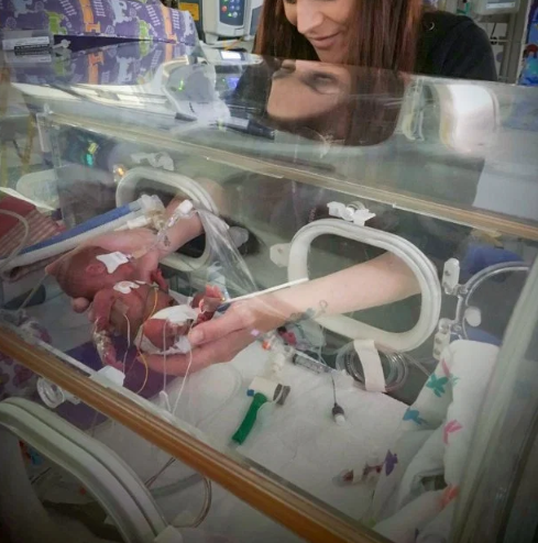 世界上最小双胞胎男孩:23周出生时只有巴掌大小 奇迹生还