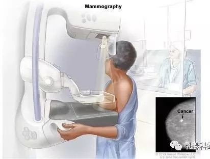 (mlo位:内外侧斜位)常规的乳腺x线检查包括2个位置的拍片,头足轴位