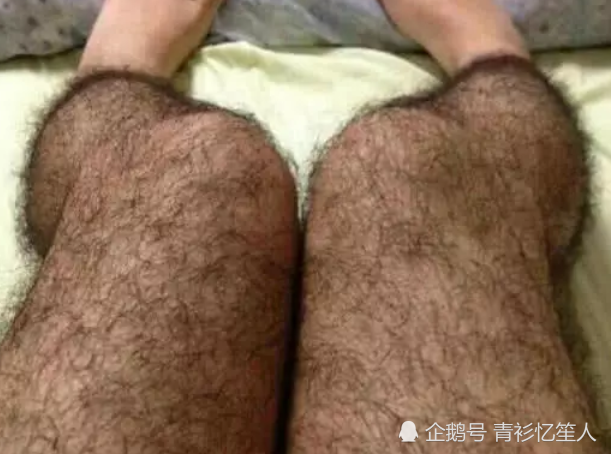 为什么有人腿毛旺盛,有人却"光溜溜"?护士姐姐"说出"