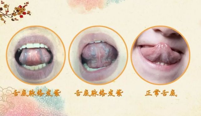 结节到底是什么?