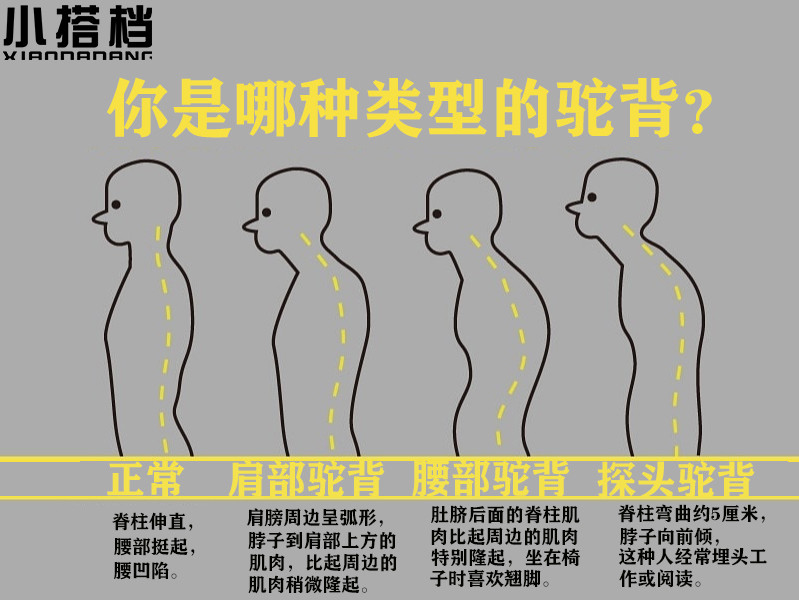 你是哪种类型的驼背?