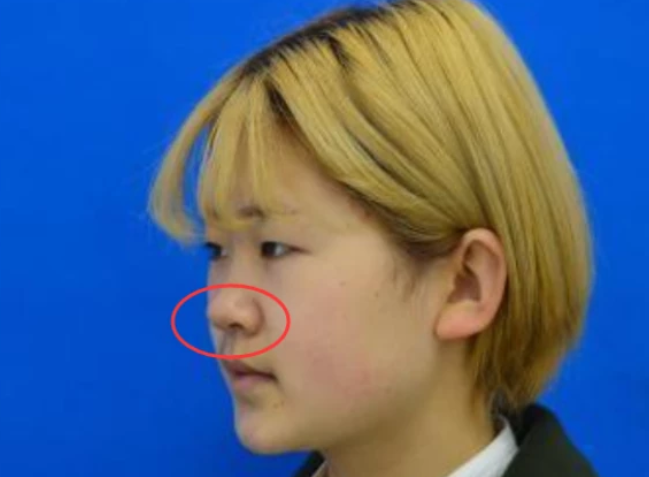 什么叫"一鼻毁所有"?若女生有这3种鼻型,五官再精致也