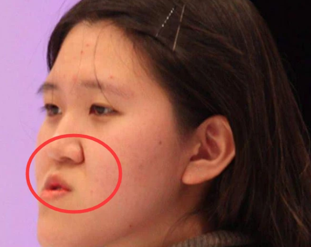青春期女生"贼伤鼻子"的行为,难怪没异性缘,原来是鼻子在捣乱