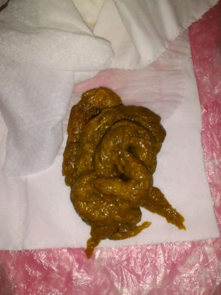 看宝宝大便颜色识健康宝妈必学