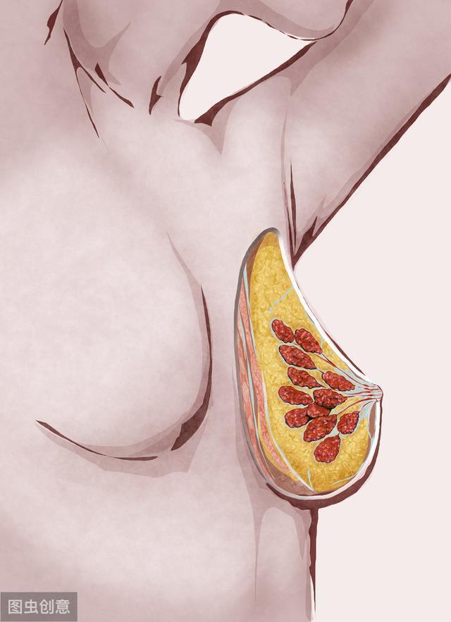 乳腺癌多是拖出来的,乳房早期的3个"异常",大多都忽略