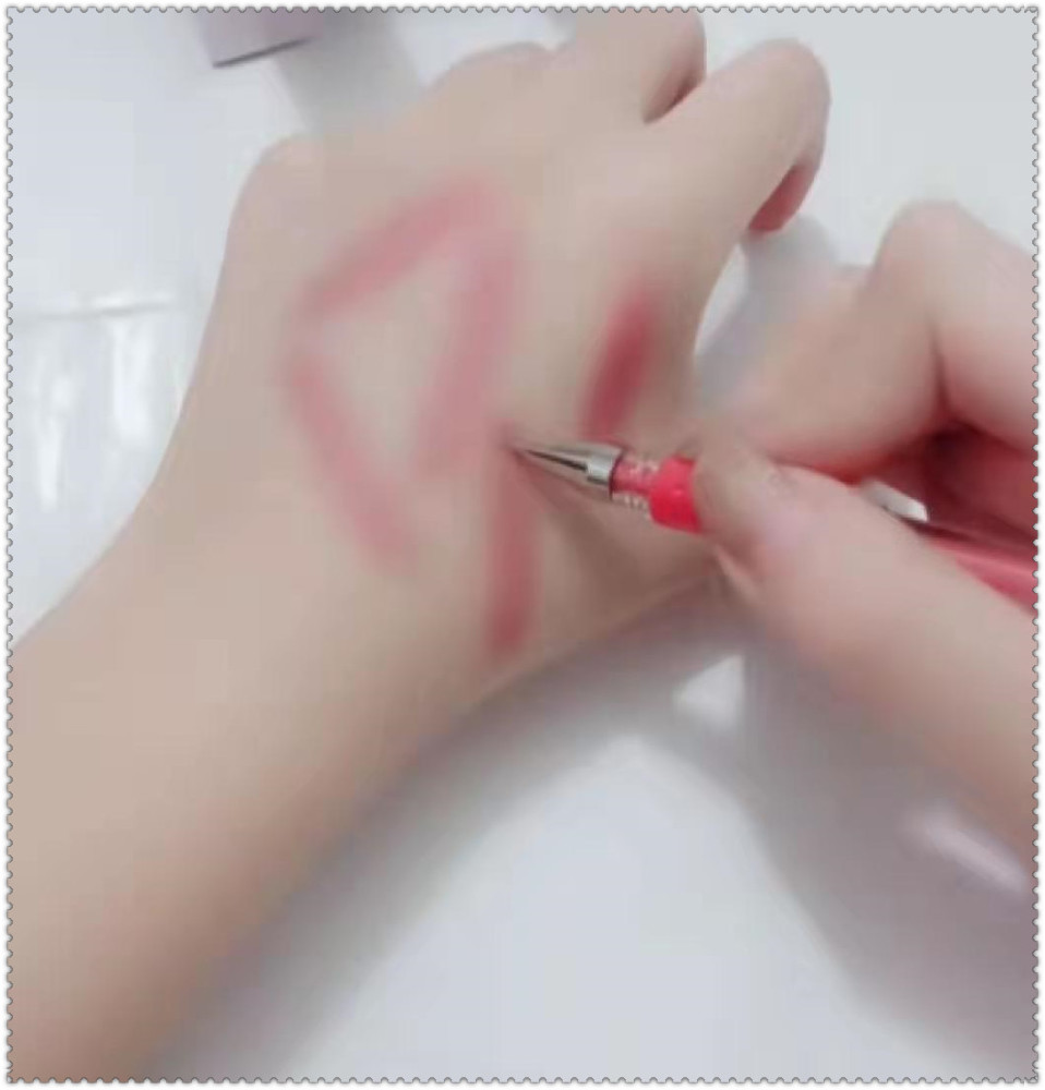 美术生手上画"猫抓伤",第一眼:逗我玩呢,最后:能骗老师不?
