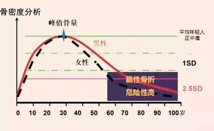 女性绝经后,男性50岁后,钙吸收能力衰退,骨密度,骨质量就会大幅降低