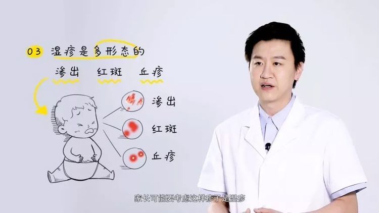 发烧,黄疸,湿疹,便秘,新手妈妈最怕的4件事,也最容易出错