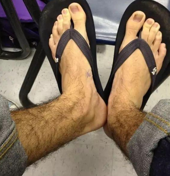 为何有些男孩子腿毛旺盛有些却光溜溜青春期男生应早了解
