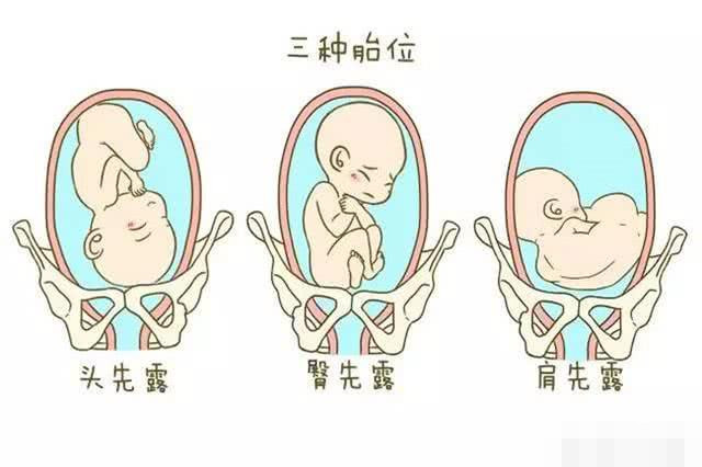 胎心在肚脐左下方是什么胎位?说出来你都不一定会信,涨知识了
