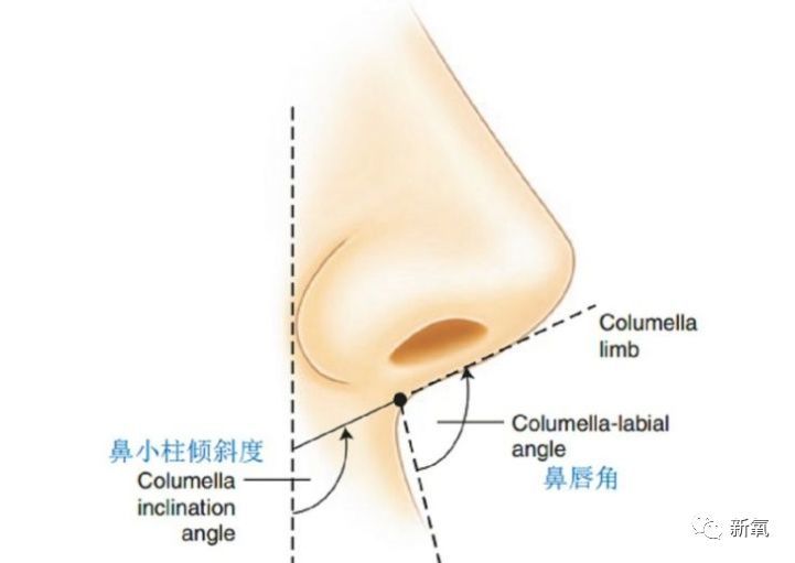 鼻小柱和上唇延伸线间的夹角为鼻唇角,鼻小柱和竖直垂线间的夹角被称