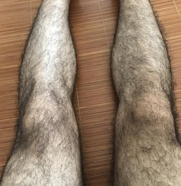 青春期男生腿毛少是发育不良吗了解真实答案后学生党心服口服