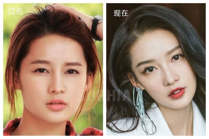 脸部骨感强,不够女性化?