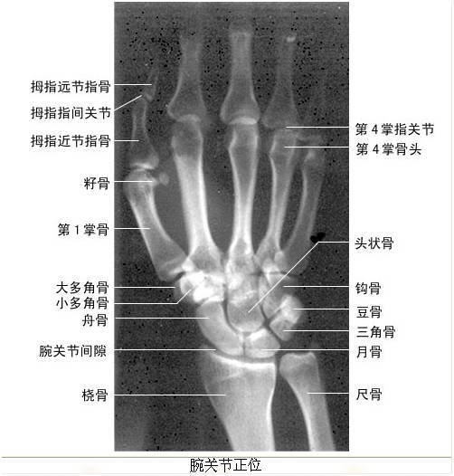 【绝版收藏】x线解剖