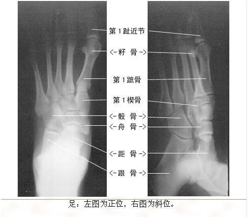 【绝版收藏】x线解剖