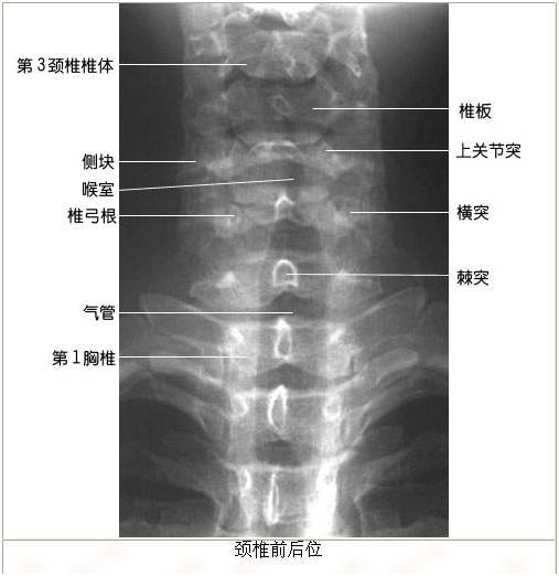 【绝版收藏】x线解剖