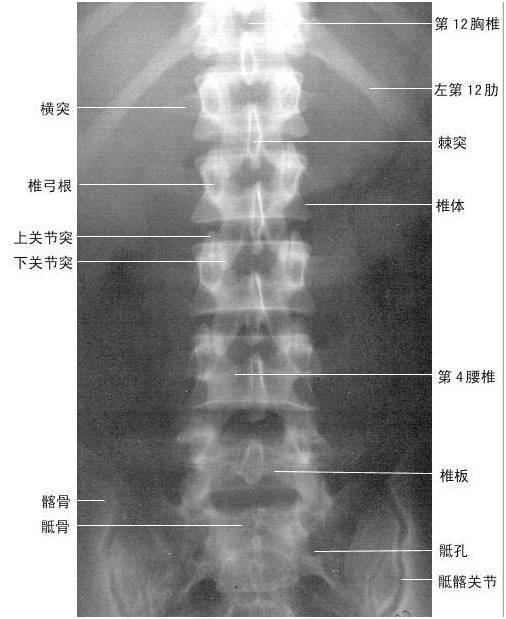 【绝版收藏】x线解剖