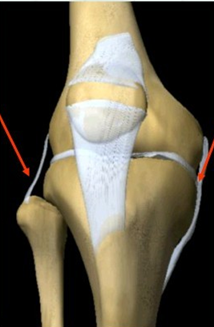 关于"膝关节内,外侧副韧带损伤"的知识,一网打尽!
