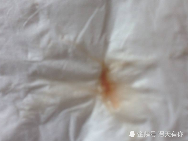 内"裤"上出现这种"迹象",或是"宫颈癌"作怪,女人早知