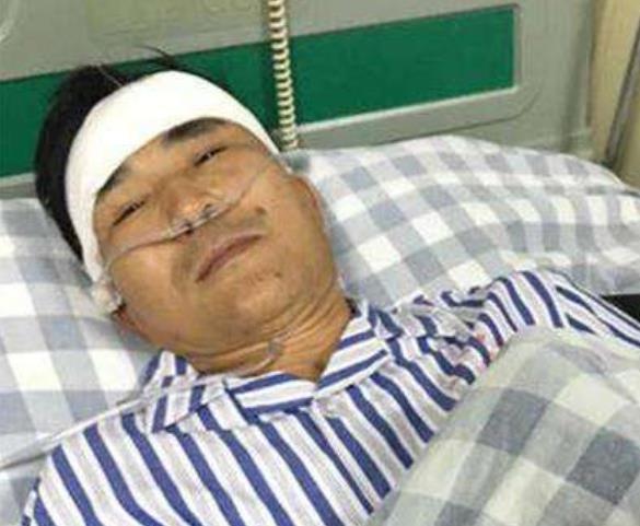 身体频繁出现3个"奇特点",很遗憾,肝硬化即将进入晚期