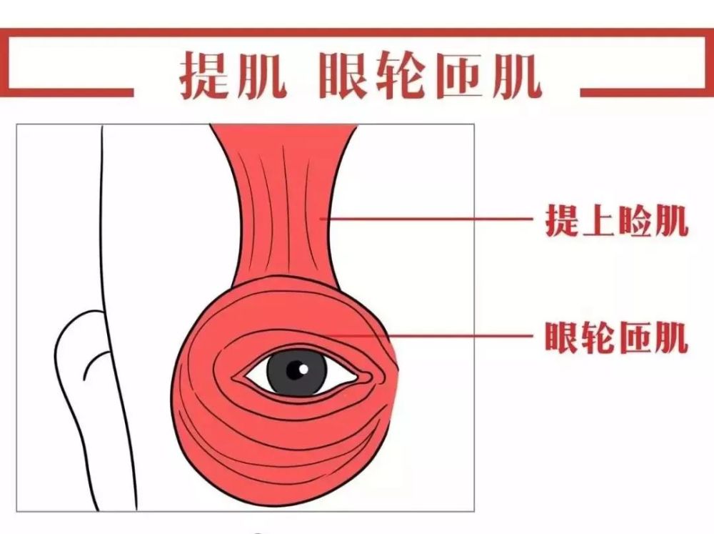 有的人天生上睑提肌无力,睁眼困难,眼睛无法完全睁开,眼珠被眼皮遮盖