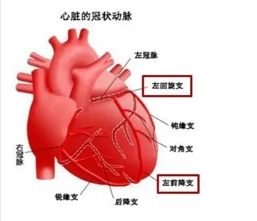 31岁,心脏血管长在了心脏肌肉里面,导致了心梗,叫作心肌桥