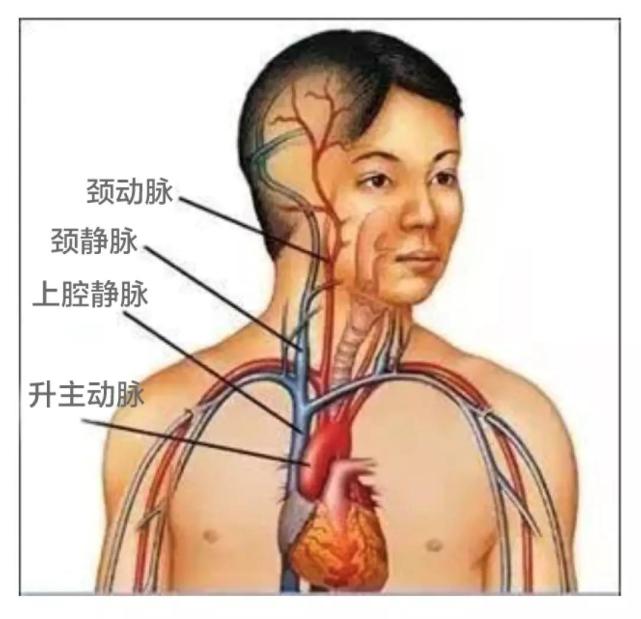 就是上腔静脉被肿物压迫了之后,上肢,面部的血液回流心脏受阻,面部