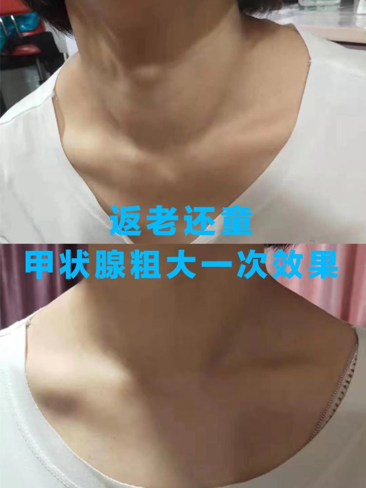 留给自己从事美容行业二十余年的解晓丽,专注于美容,减肥,丰胸方面的