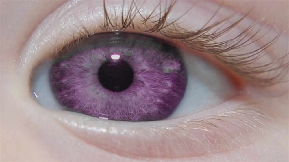 10种"最稀有"的眼球颜色!十分罕见,觉得有意思吗?