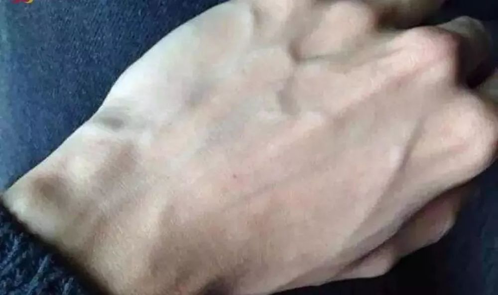 手上青筋越多,说明身体越差?看完这3点,或许你就明白了