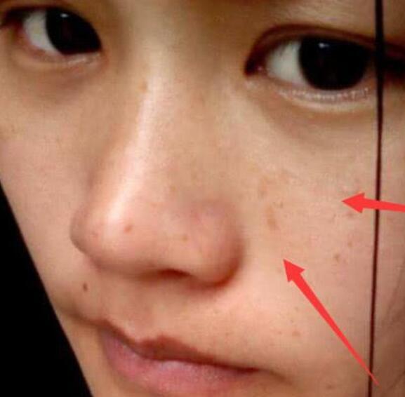 子宫"脏兮兮"的女孩子,身上会有"2黑1臭",一个不占恭喜喽!