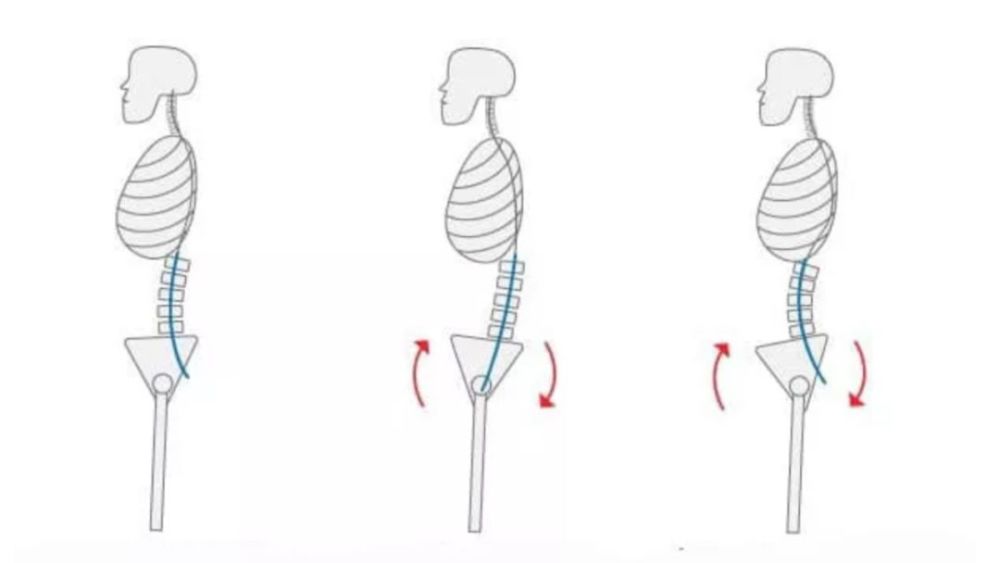 骨盆前倾(骨盆前后发生倾斜) 很多人知道这个词很有可能是从"假翘臀"