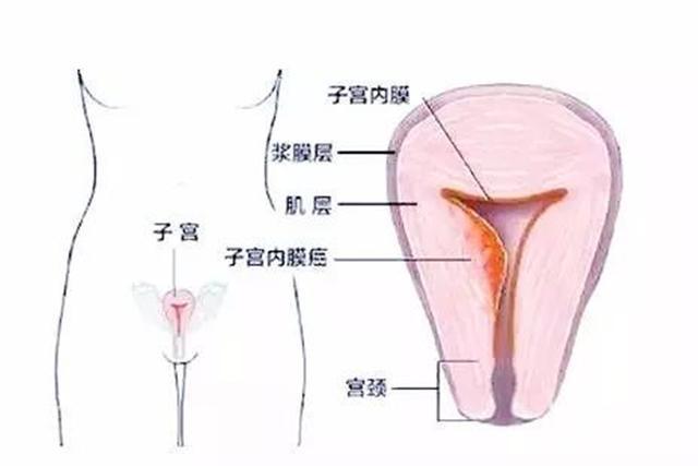 人口增长 指望 子宫(3)