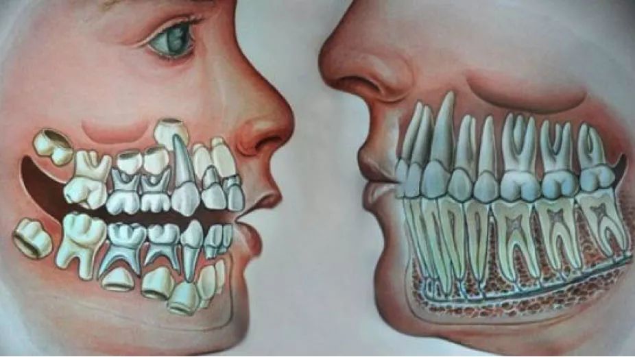 一两副牙齿就足以过完凶险的一生;而形状不同的牙齿不能代劳,定期换牙