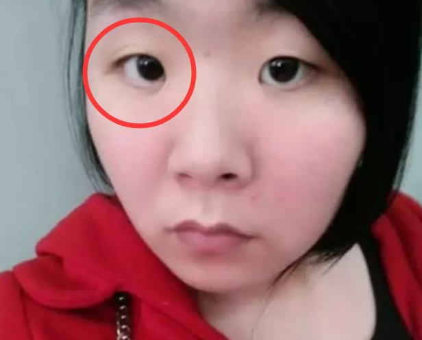 2.三角眼