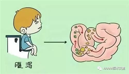 刮痧第十一课:腹泻