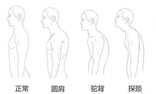 几个练背动作,纠正圆肩驼背,改善体态