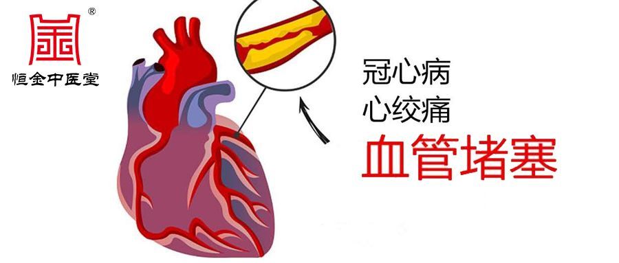 冠心病最好的治疗方法是什么?