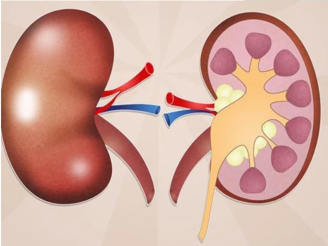 "肾脏"发出的3种求救信号,若全中,需警惕,肾脏或许""