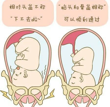 胎儿入盆是不是代表着快生了?还要看两个症状,满足后提前做准备